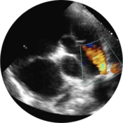 Ecocardiografía veterinaria
