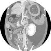 Tomografía axial computarizada veterinaria